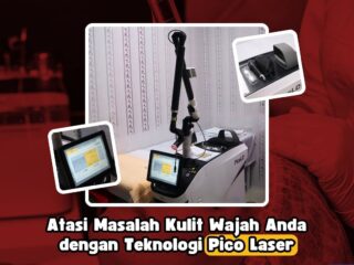 Pico Laser: Terobosan Baru dalam Perawatan Kulit di Poliklinik Kosmetik Medik RSD Idaman Kota Banjarbaru